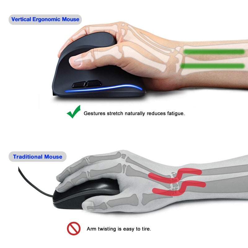 TRELC Ergonomic Mouse, 2.4G Wireless Vertical Optical Mouse with Adjustable Sensitivity (1000/1600/2400 DPI), 6 Buttons for PC, Desktop, Laptop, Notebook (Black) - Image 2